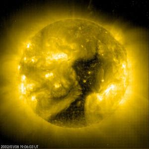 images/trouCoronal.jpg